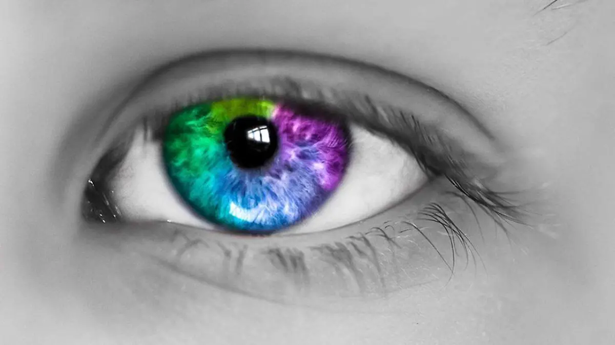 La heterocromia, la cual consiste en que los iris de una persona son de distinto color